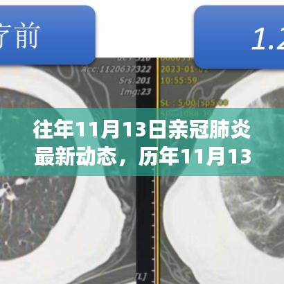 历年11月13日新冠肺炎动态回顾，最新进展、当前动态与未来展望
