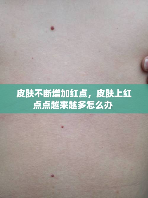 金石为开 第2页