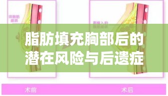 脂肪填充胸部后的潜在风险与后遗症解析