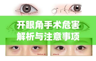 开眼角手术危害解析与注意事项指南——百度健康知识分享